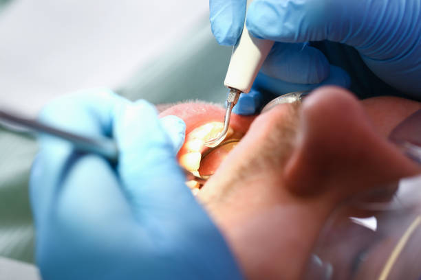 Best Emergency Root Canal Therapy in Uvalde, TX